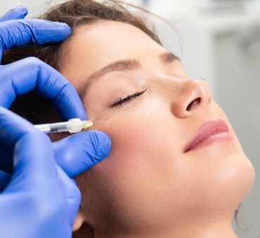 Medicina Estética - Botox