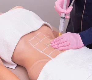 Ozonoterapia en la parte baja del abdomen